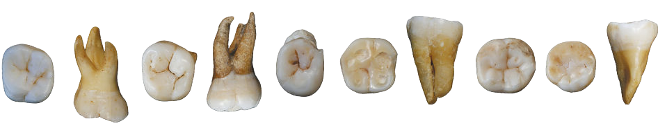 An image of a row of teeth.